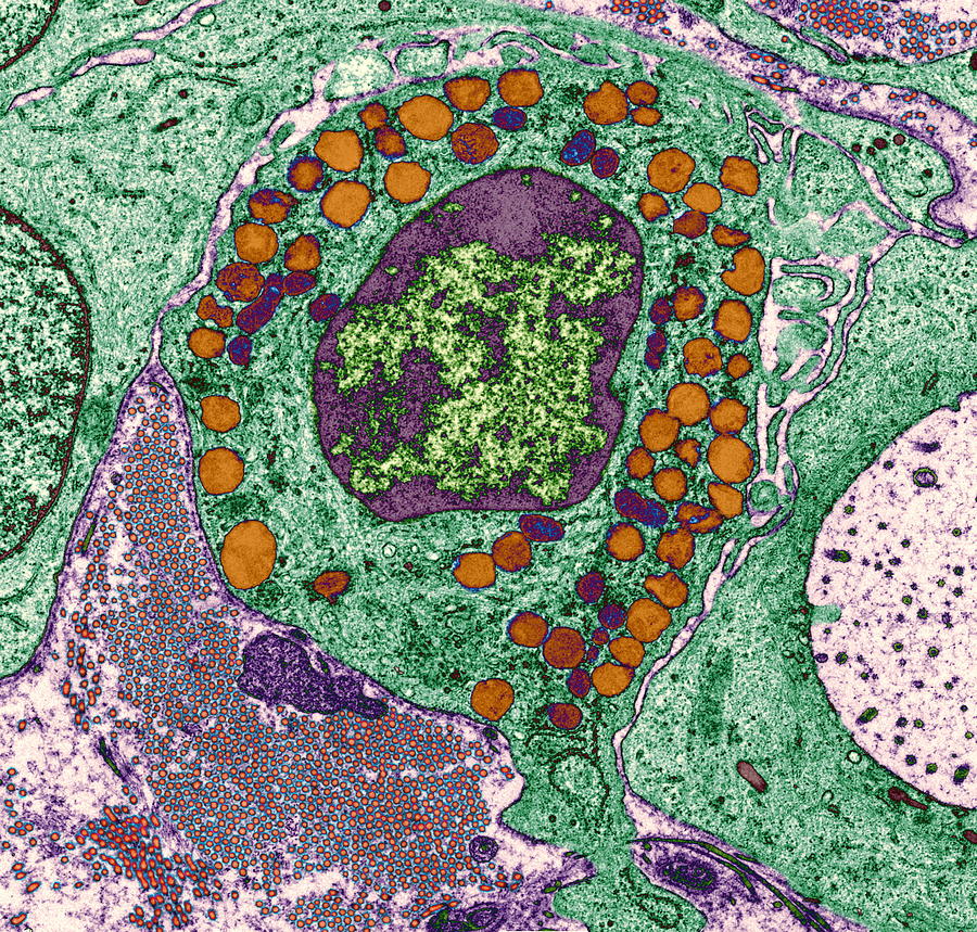 Basophil White Blood Cell by Steve Gschmeissner / Science Photo Library