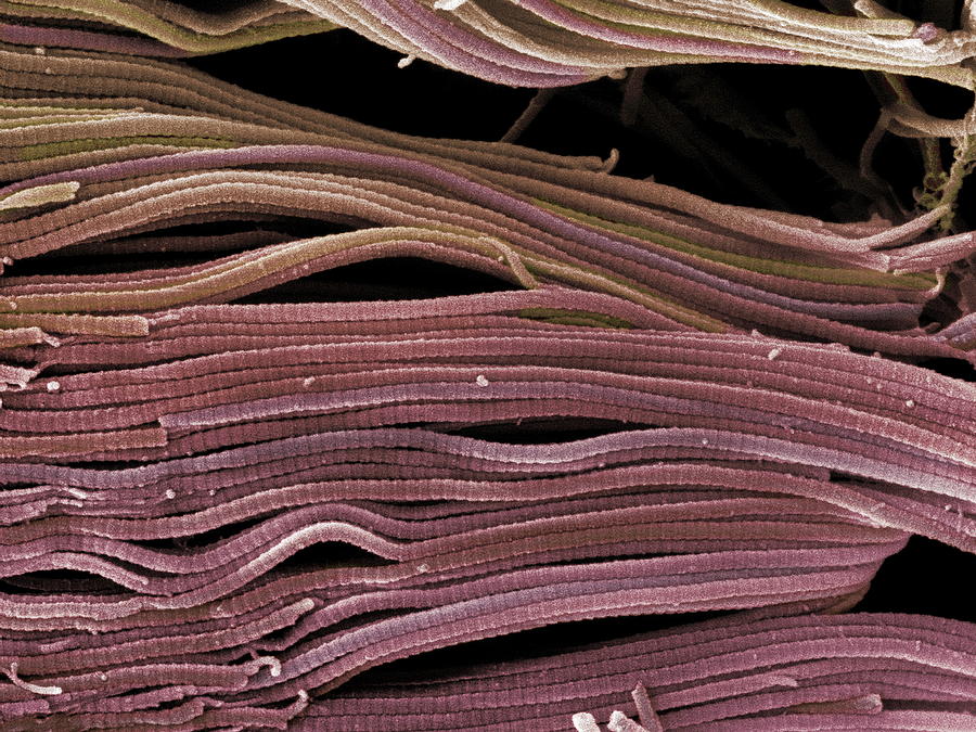 Collagen Bundles, Sem by Steve Gschmeissner / Science Photo Library
