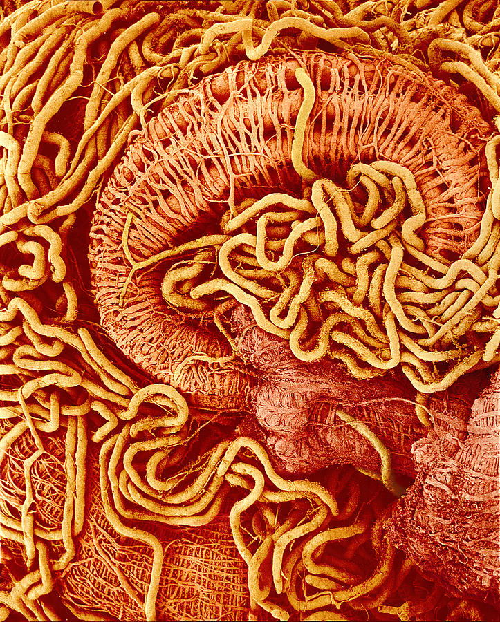 Honey Bee Excretory System, Sem by Susumu Nishinaga / Science Photo Library
