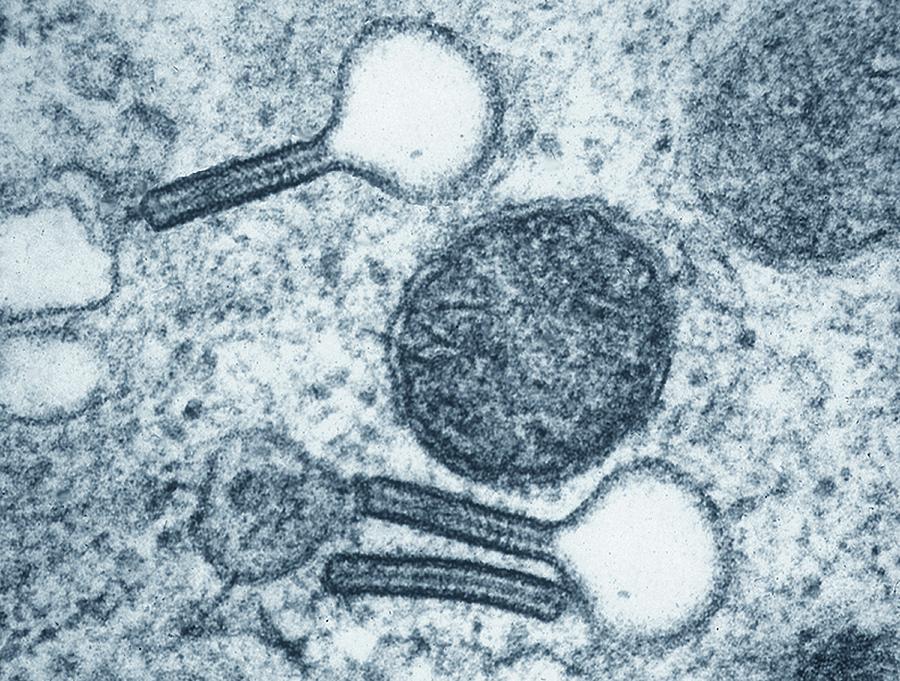Langerhans Cell, Tem by Zephyr / Science Photo Library
