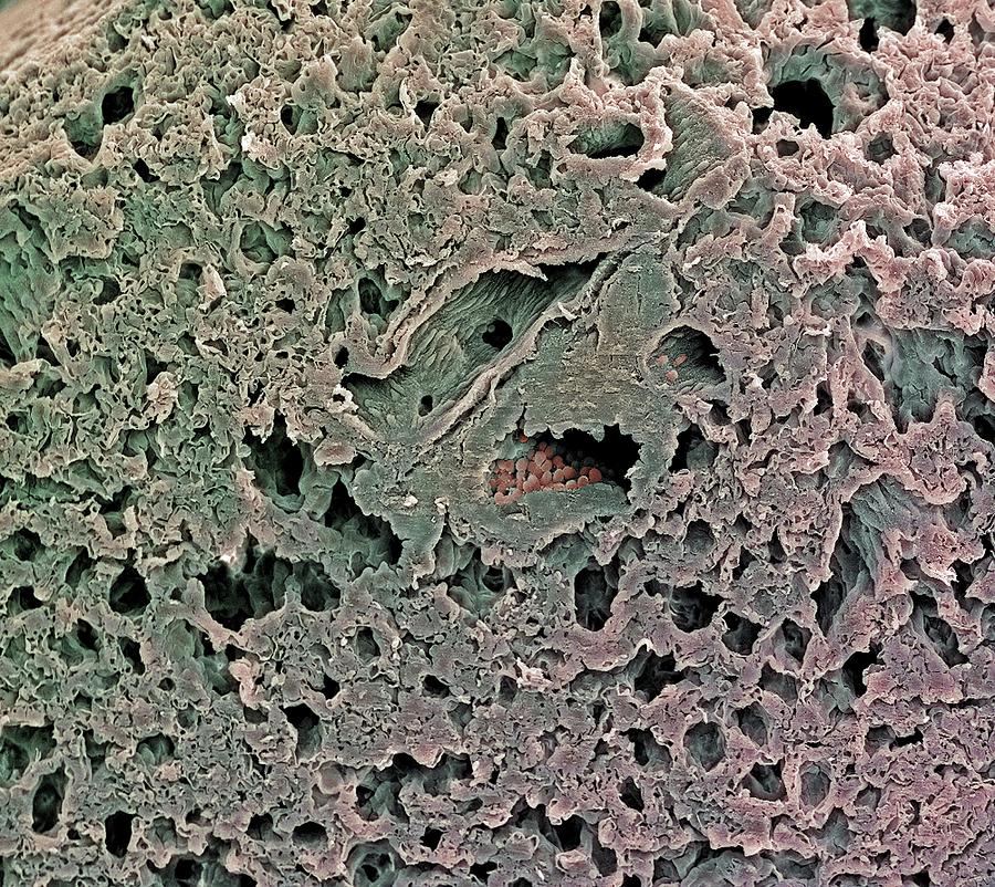 Real Alveoli Under Microscope