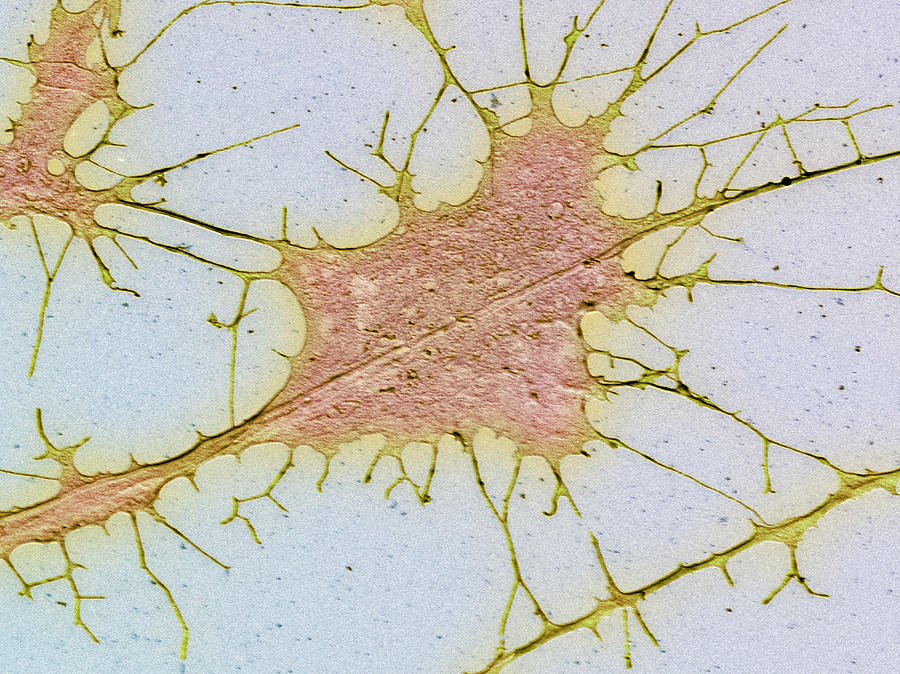 Nerve Cell Culture, Sem by Steve Gschmeissner / Science Photo Library