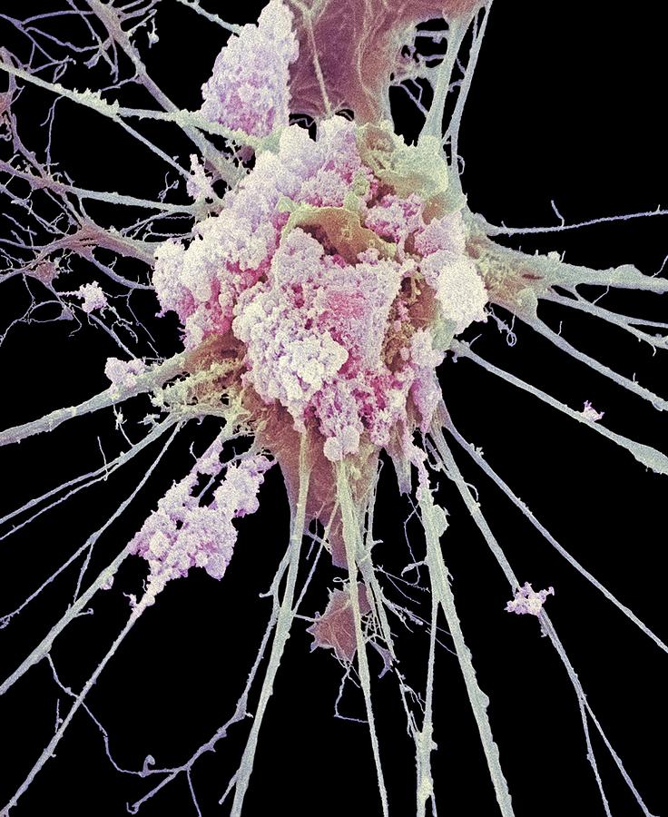 Nerve Cell, Sem by Steve Gschmeissner / Science Photo Library