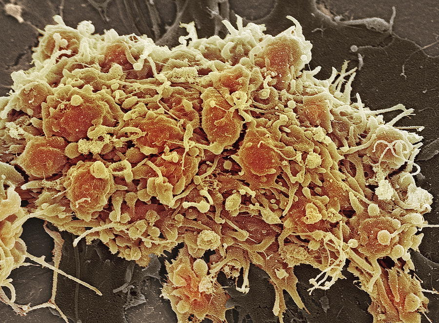 Platelets In A Blood Clot by Steve Gschmeissner / Science Photo Library