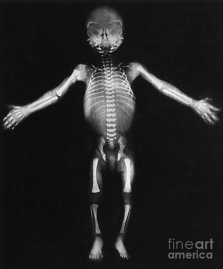 Skeleton Of A Baby by Photo Researchers