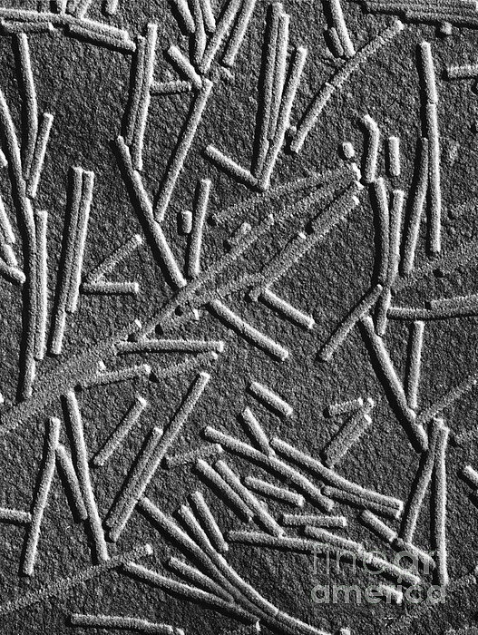 Tobacco Mosaic Virus, Microscopic Photo, Tem iPhone Case