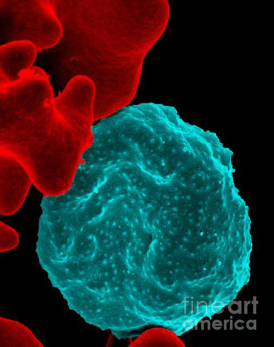 Malaria-infected Red Blood Cell, Sem Greeting Card by Science Source