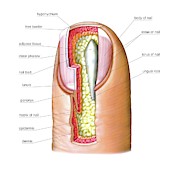 Fingernail #2 Wood Print by Asklepios Medical Atlas / Science Photo ...