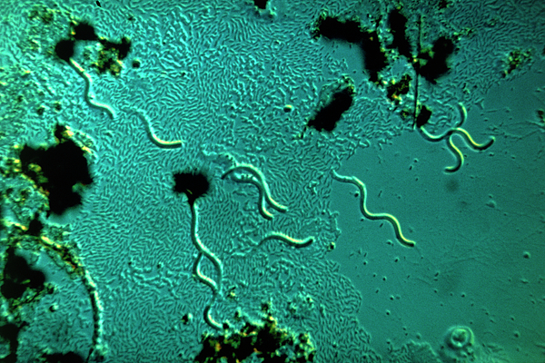 Spirocheten Light Micrograph Of Spirochaetes Bacteria Greeting Card by Eric Grave ...