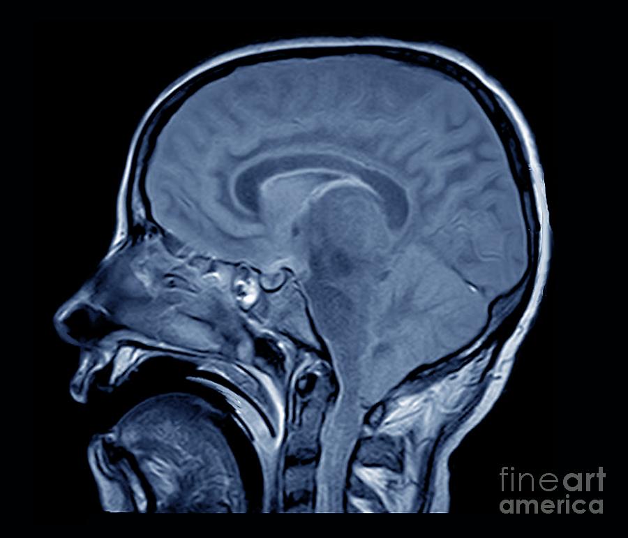 Brain Death Test #1 by Zephyr / Science Photo Library