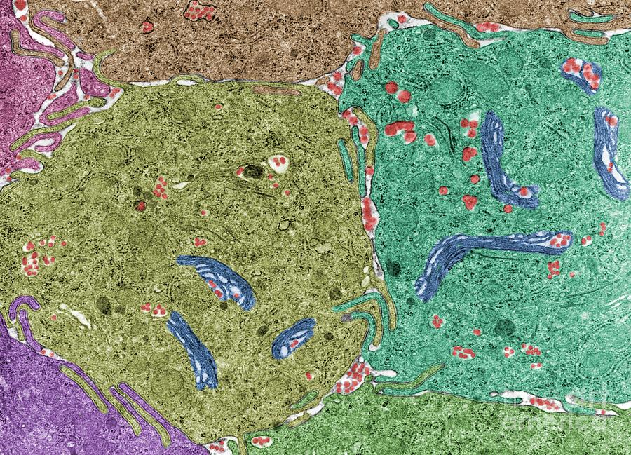 Chylomicrons In Intestinal Cells #1 by Jose Calvo / Science Photo Library
