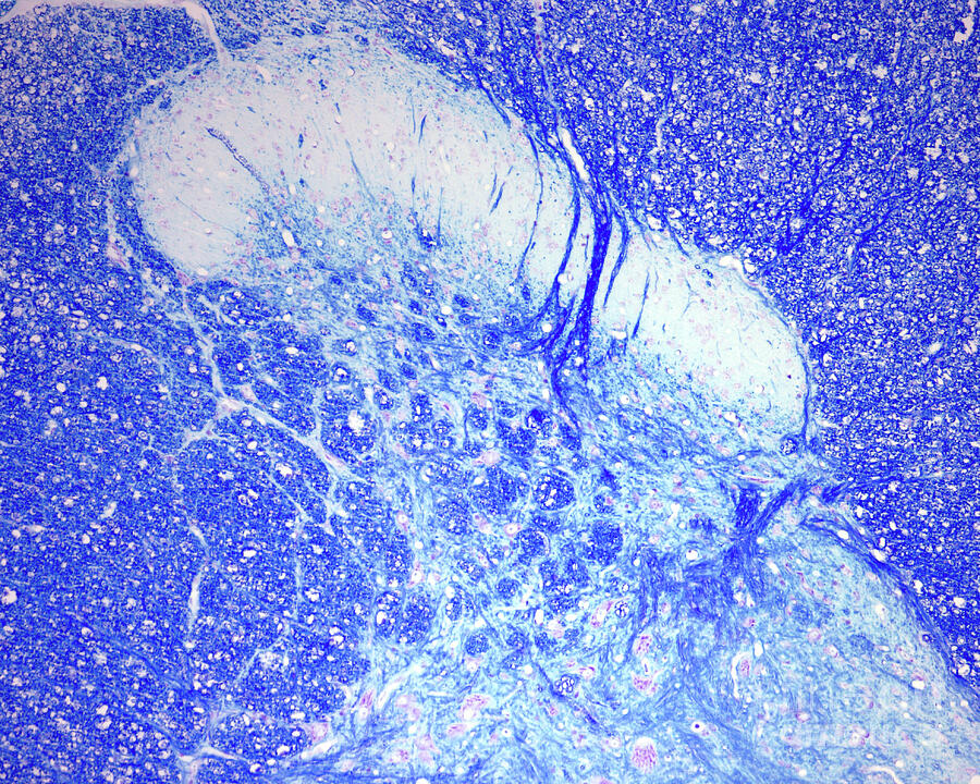 Dorsal Horn Of Spinal Cord #1 by Jose Calvo / Science Photo Library