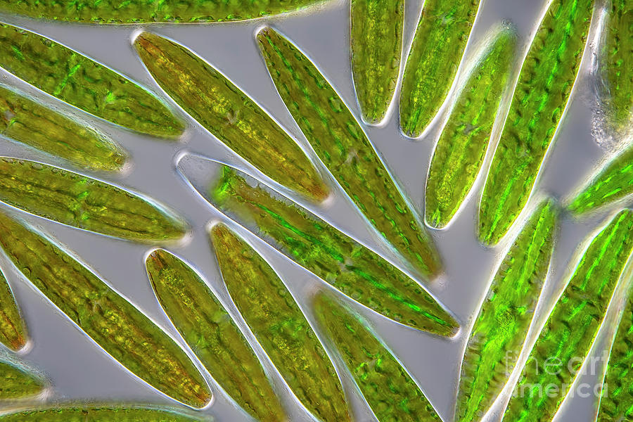 Netrium Digitus Netrium Digitus Algae #1 by Frank Fox / Science Photo Library