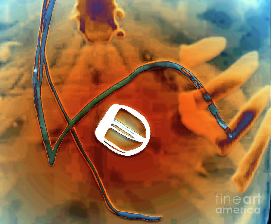 Prosthetic Aortic Valve And Pacemaker Wires #1 by Zephyr / Science ...