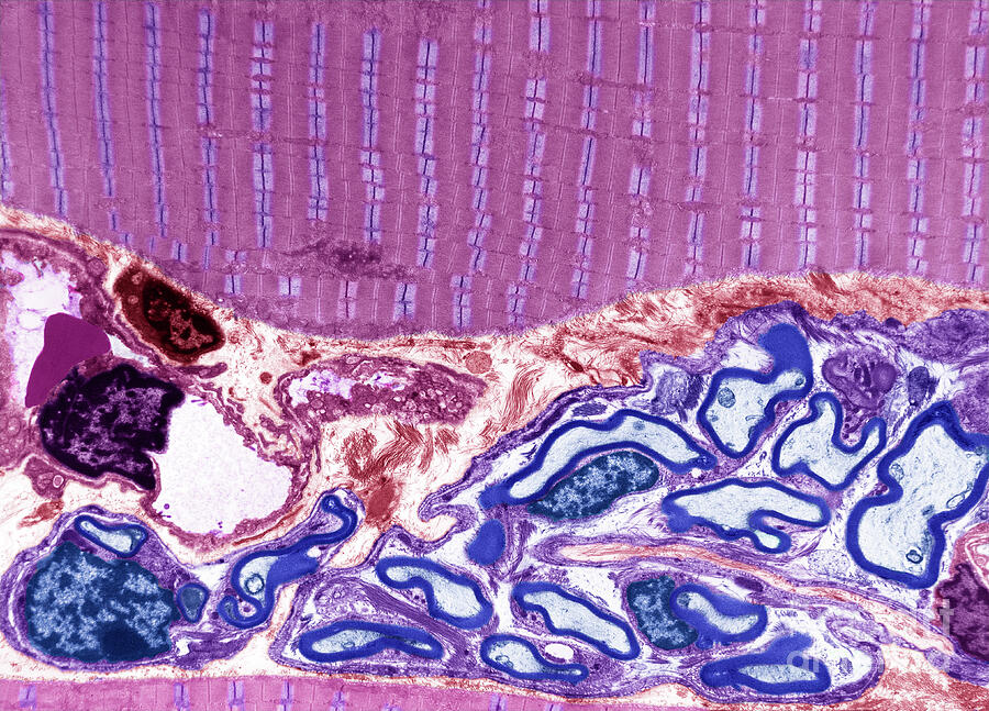 Skeletal Muscle And Nerve #1 by Steve Gschmeissner / Science Photo Library