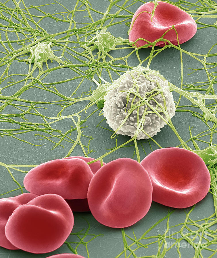 Blood Cells #10 by Steve Gschmeissner / Science Photo Library