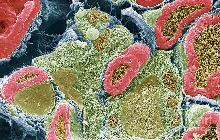 Peripheral Nerve #13 by Steve Gschmeissner / Science Photo Library
