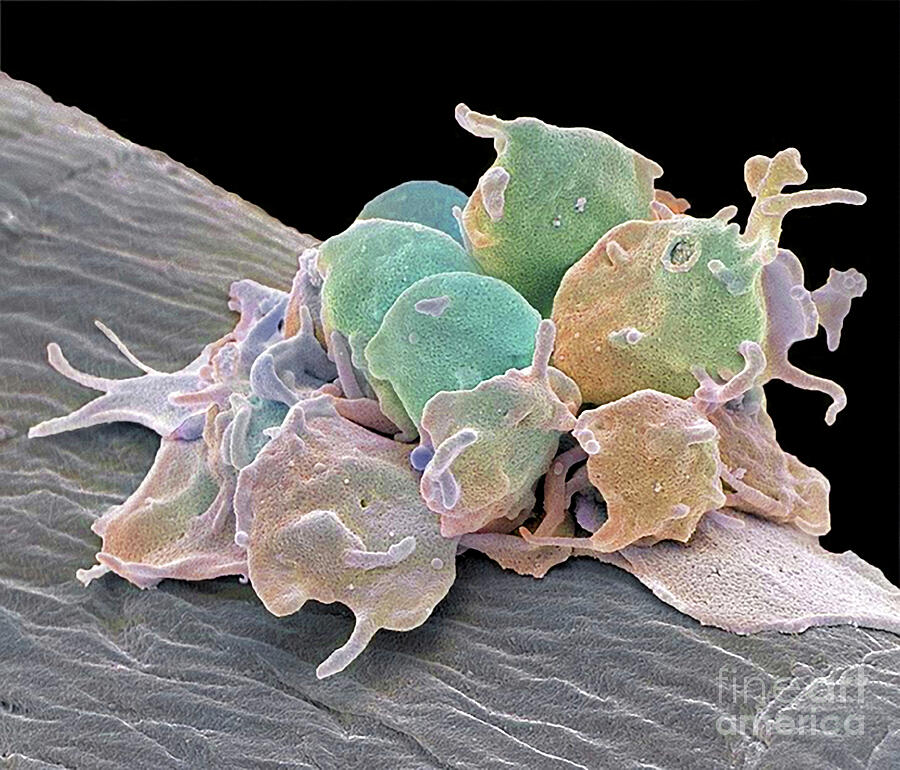 Activated Platelets #14 by Steve Gschmeissner / Science Photo Library