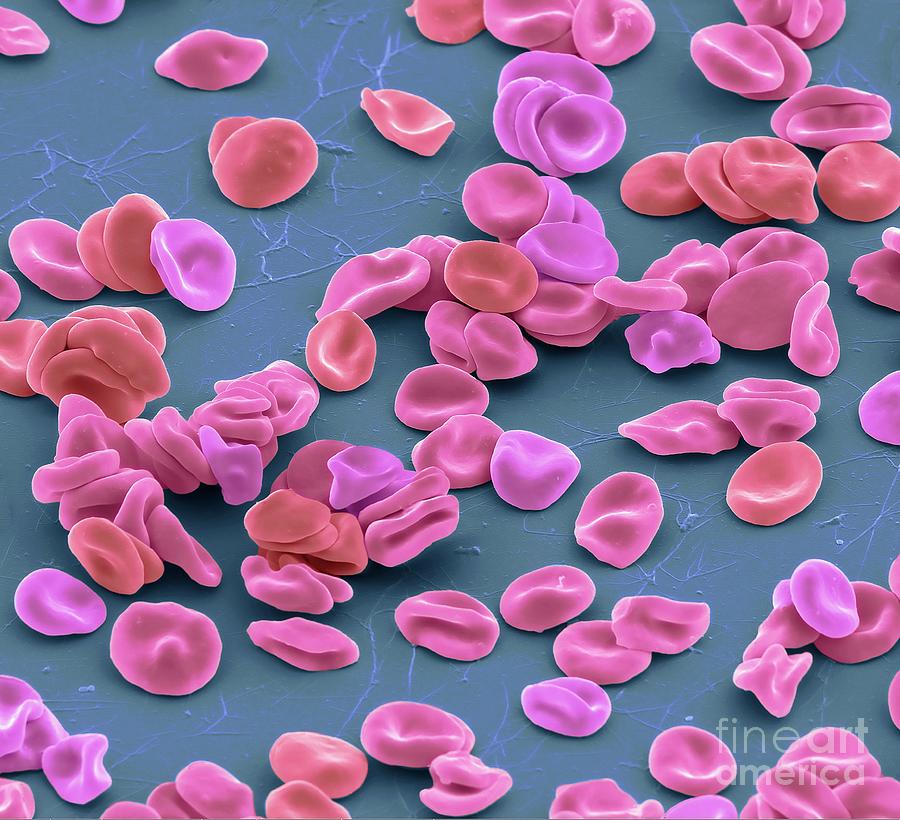 Red Blood Cells #15 by Steve Gschmeissner / Science Photo Library