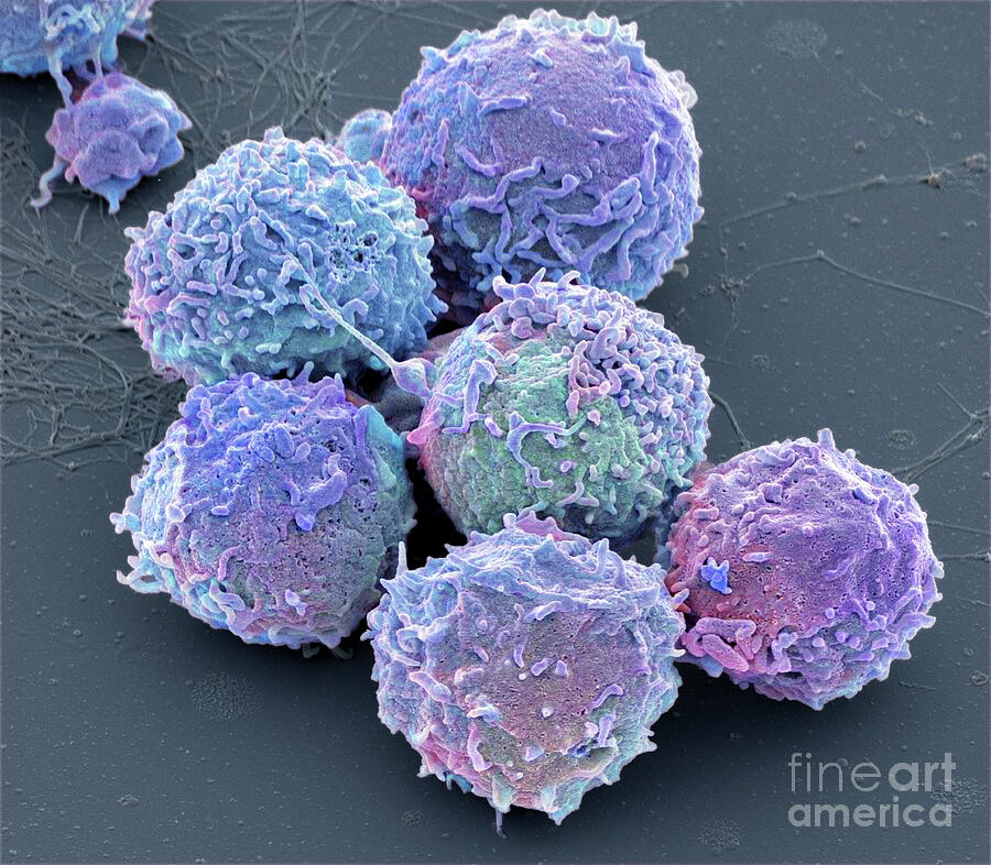 White Blood Cells #15 by Steve Gschmeissner / Science Photo Library