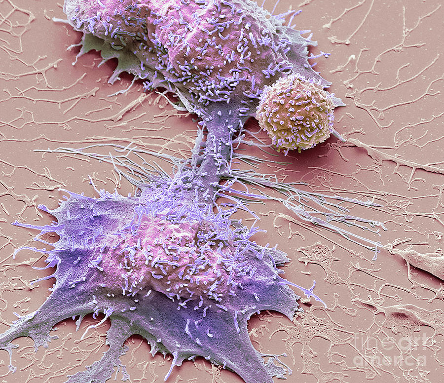 Natural Killer Cell And Cancer Cell #18 by Steve Gschmeissner / Science ...