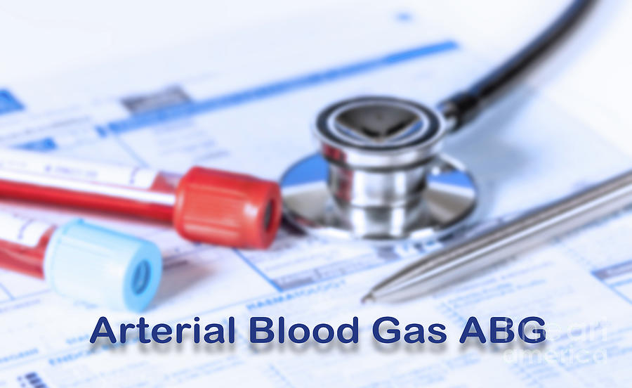 Arterial Blood Gas Test #2 by Wladimir Bulgar / Science Photo Library