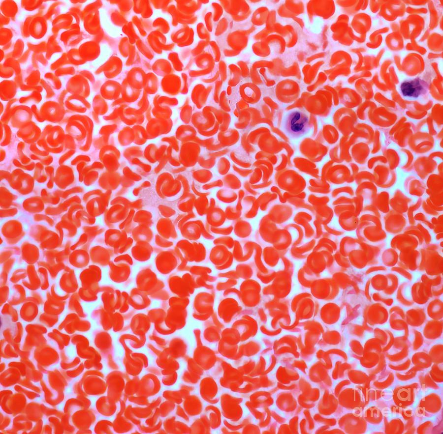Blood Smear #2 by Steve Gschmeissner / Science Photo Library