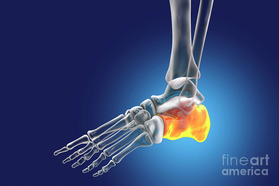 Calcaneus Bone #2 by Kateryna Kon / Science Photo Library