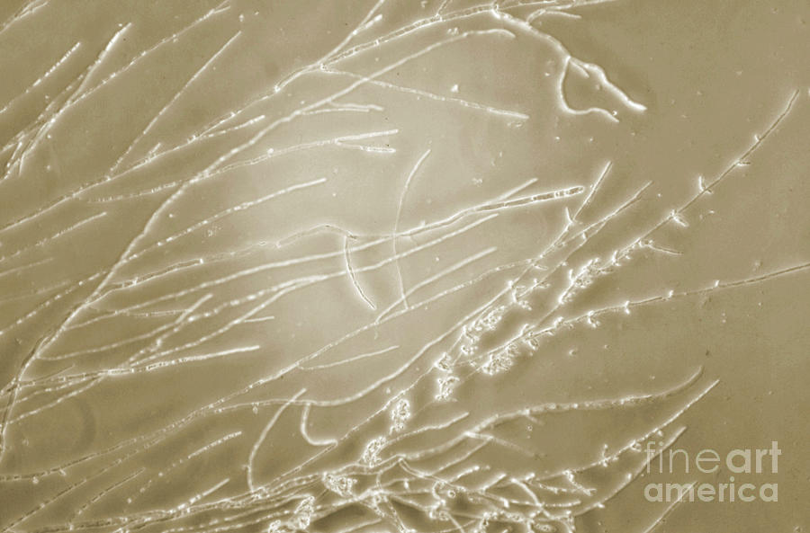 Candida Albicans Fungus #2 by Cdc / Science Photo Library