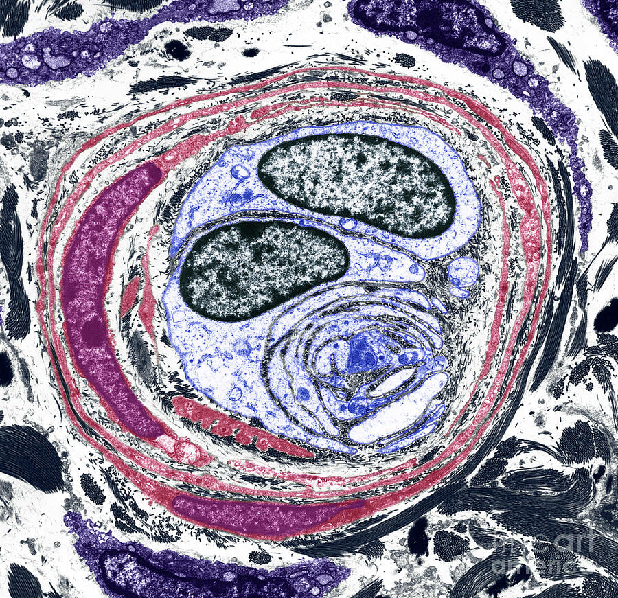 Nerve Ending #2 by Steve Gschmeissner / Science Photo Library