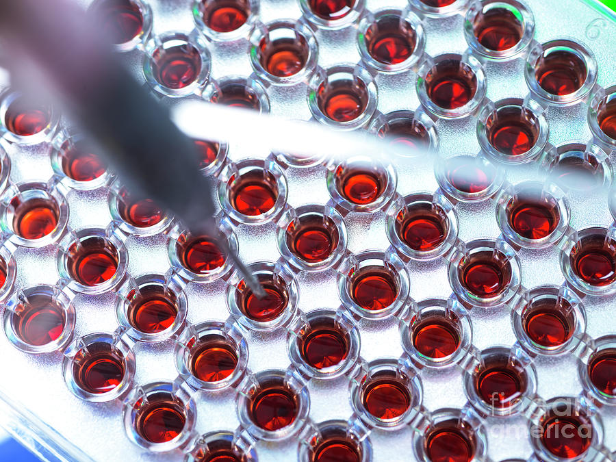 Blood Testing #21 by Tek Image / Science Photo Library