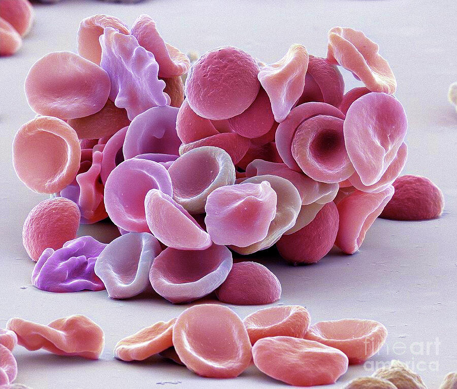 Red Blood Cells #25 by Steve Gschmeissner / Science Photo Library