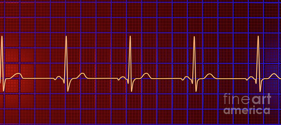 Healthy Heartbeat Rhythm #3 by Kateryna Kon / Science Photo Library