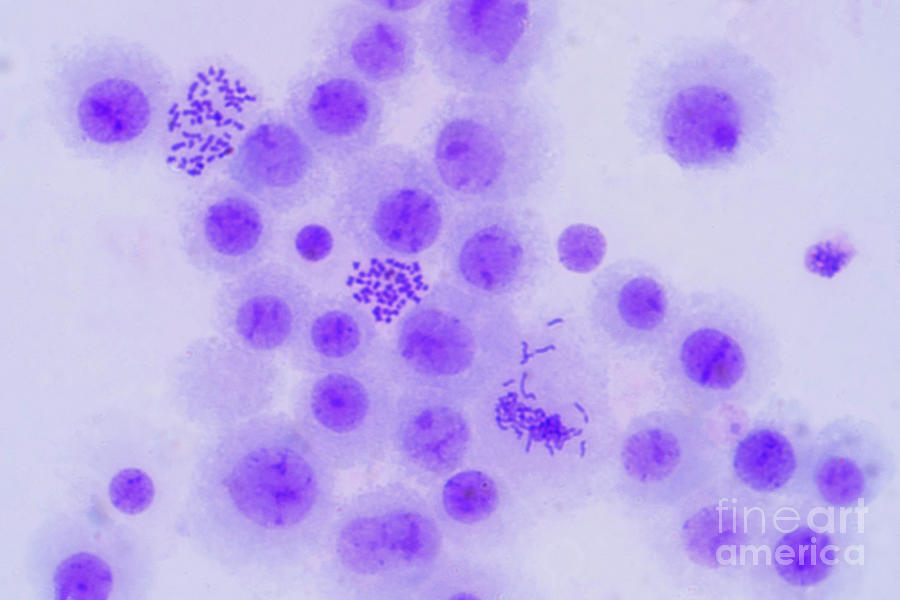 Mitosis #4 by Choksawatdikorn / Science Photo Library