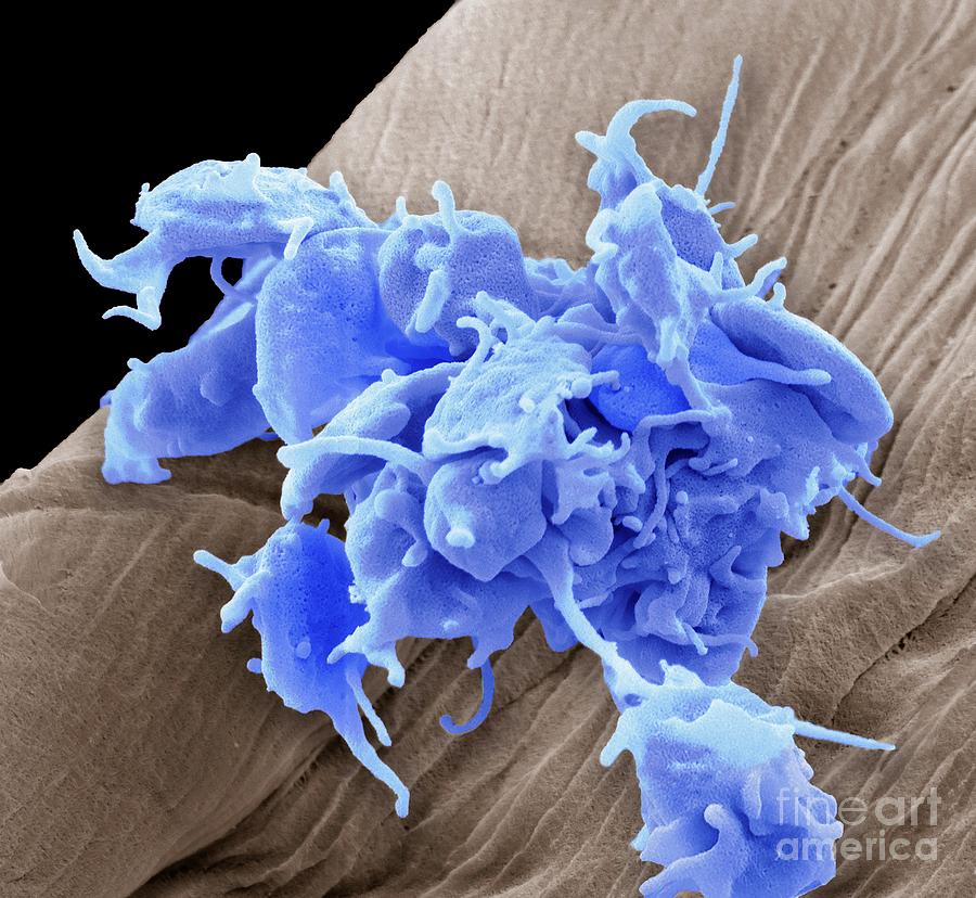 Activated Platelets #6 by Steve Gschmeissner / Science Photo Library