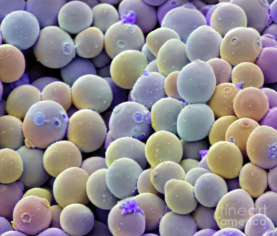Yeast Cells #6 by Steve Gschmeissner / Science Photo Library