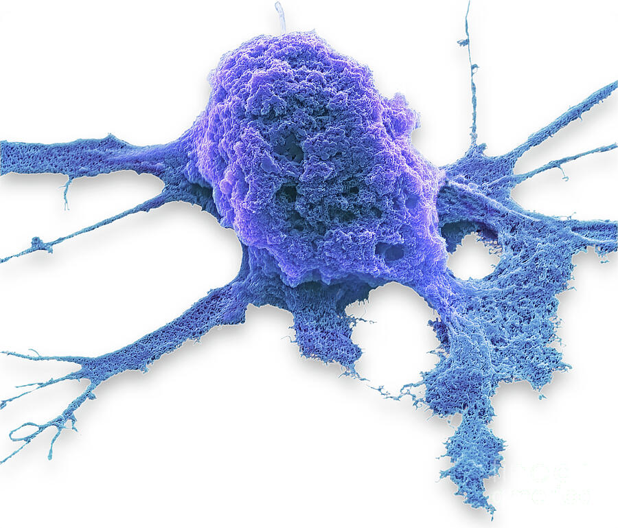 Chemotherapy #7 by Steve Gschmeissner / Science Photo Library