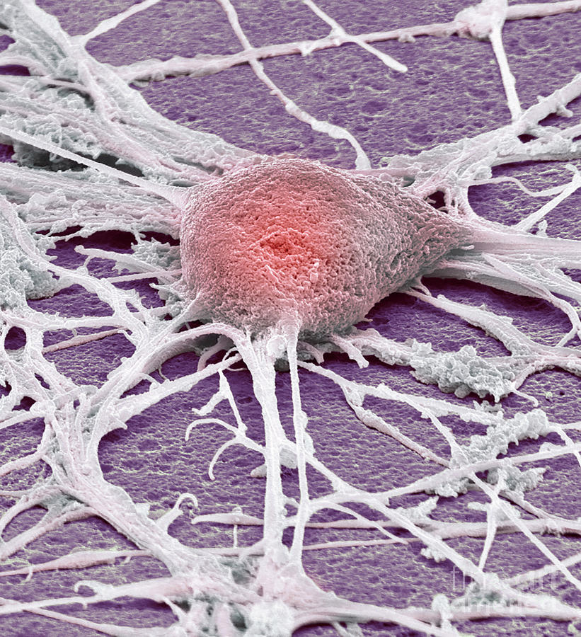 Neurone #8 by Steve Gschmeissner / Science Photo Library
