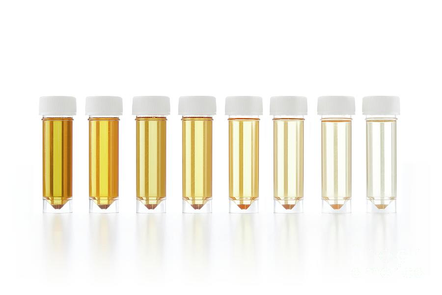 Urrine Sample Urine Samples For Analysis #8 by Science Photo Library