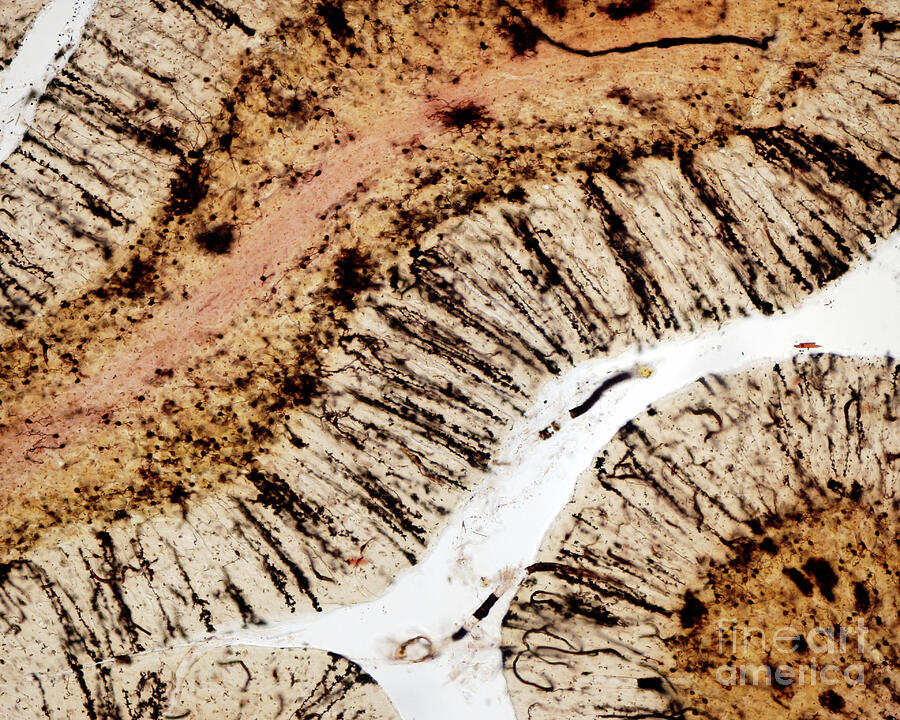 Bergmann Glia Cells In Cerebellar Cortex by Jose Calvo / Science Photo ...