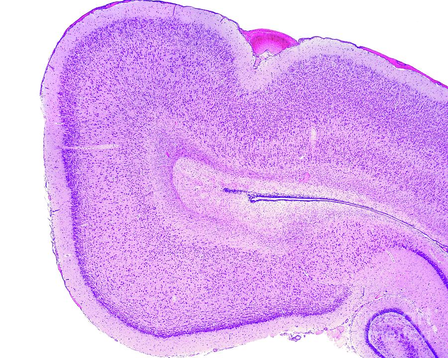 Cerebral Cortex by Jose Calvo / Science Photo Library