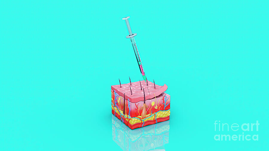 Science Injection Photo Injection by Julien Tromeur / Science Photo Library