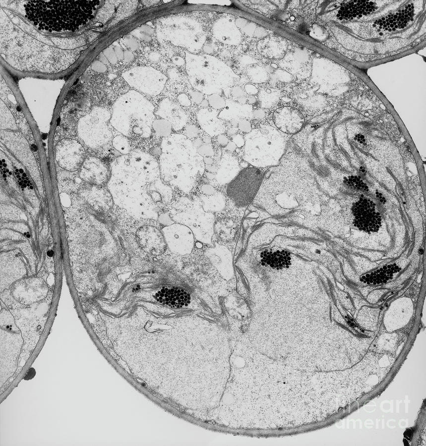 Plant Cell Before Rehydration by Marilyn Schaller / Science Photo Library