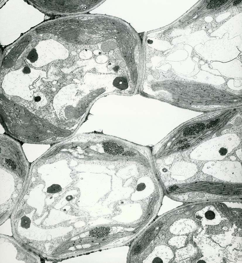 Plant Cells During Rehydration by Marilyn Schaller / Science Photo Library