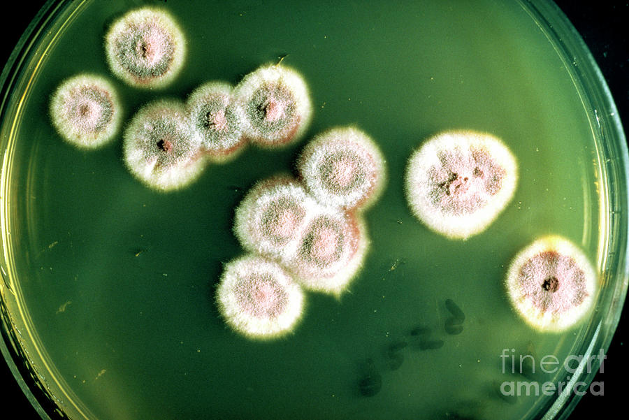 Ringworm Fungus Growing In Culture by John Durham / Science Photo