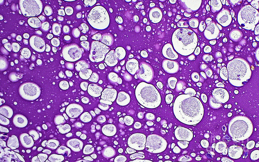 Seminal Graphics Seminal Vesicle Secretions by Ziad M. El-Zaatari / Science Photo Library
