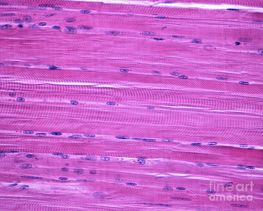 Skeletal Striated Muscle by Jose Calvo / Science Photo Library