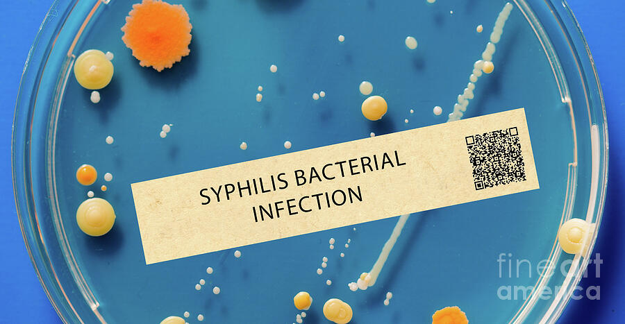 Syphilis Bacterial Infection by Wladimir Bulgar / Science Photo Library
