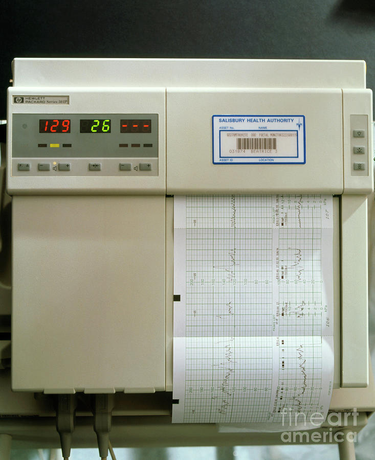 View Of A Foetal Cardiotocography (ctg) Machine by Ruth Jenkinson ...