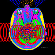 Sensory Overload - Sensory Processing Disorder -- MRI Digital Art Digital Art by Darin Volpe